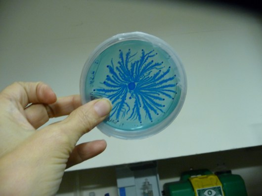 P. vortex bacteria