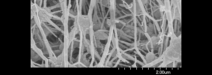 (1952) The first blood vessel replacement. You know what there was a lot of after World War II? Parachute material. Surgeon Arthur Voorhees had the idea to use it to create the first synthetic blood vessel. Today, the material most often used for arterial replacement is Gore-Tex (microscopic close-up of the material, shown), first used to insulate wires -- until creator Bill Gore was playing with a piece of it on a ski lift in Colorado. “The guy next to him was a vascular surgeon,” says Ratner. “He looked at this and said, ‘Wow, this would be great for fixing blood vessels.’”