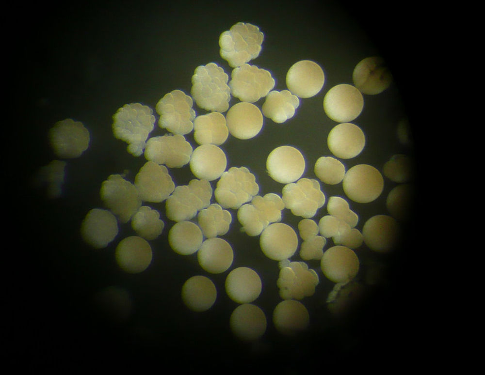 8-Star-coral-embryos-going-through-development-on-spawning-night-credit-Kristen-Marhaver