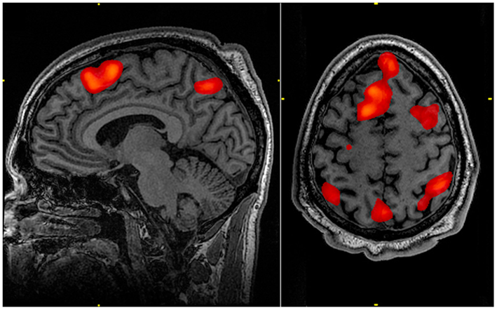 An FMRI scan during working memory tasks
